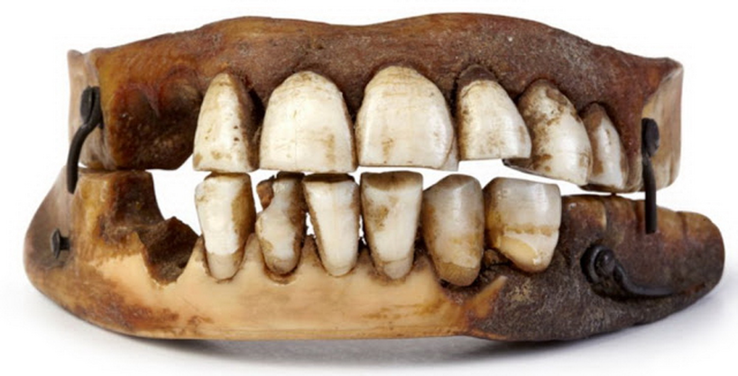 Зубные протезы зубы Ватерлоо